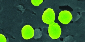 Wellesley Biologist Studies Oceans’ Smallest, Most Abundant Photosynthetic Organism A pseudo-colored image of Prochlorococcus seen under the microscope.