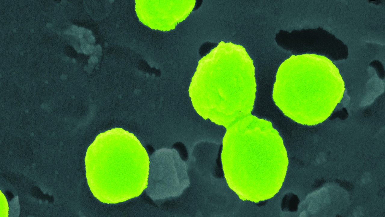 A pseudo-colored image of Prochlorococcus seen under the microscope.